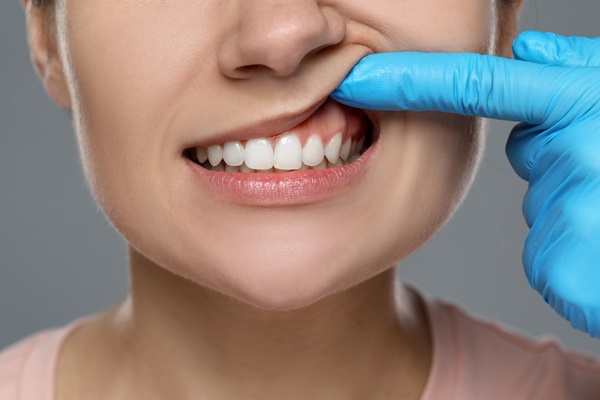 The Impact Of Periodontal Disease On Your Oral Health: What You Need To Know