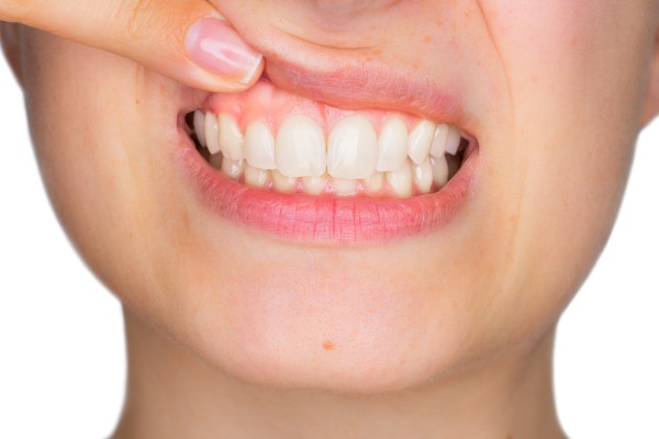 Expert Periodontist Services For Healthy Gums And Beautiful Smiles